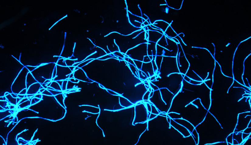 Reference UV microfiber image